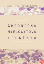 Chronick myelocytov leukmia
